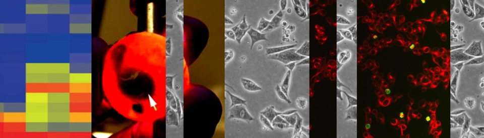 header mélanone uvéal