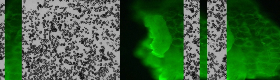 header IF Rétinoblastome