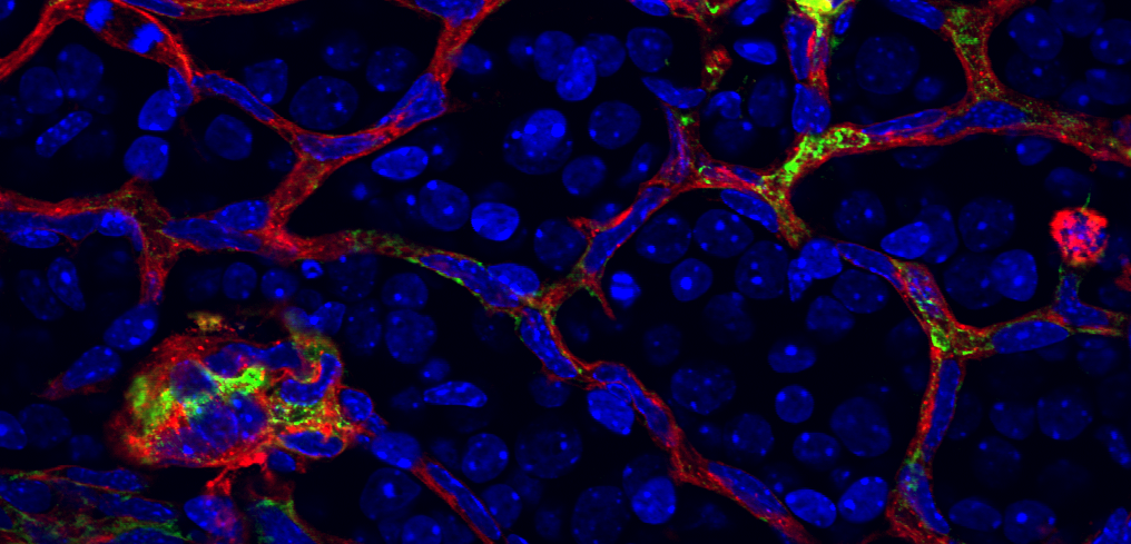 Angio5_Sapieha Cell Met2